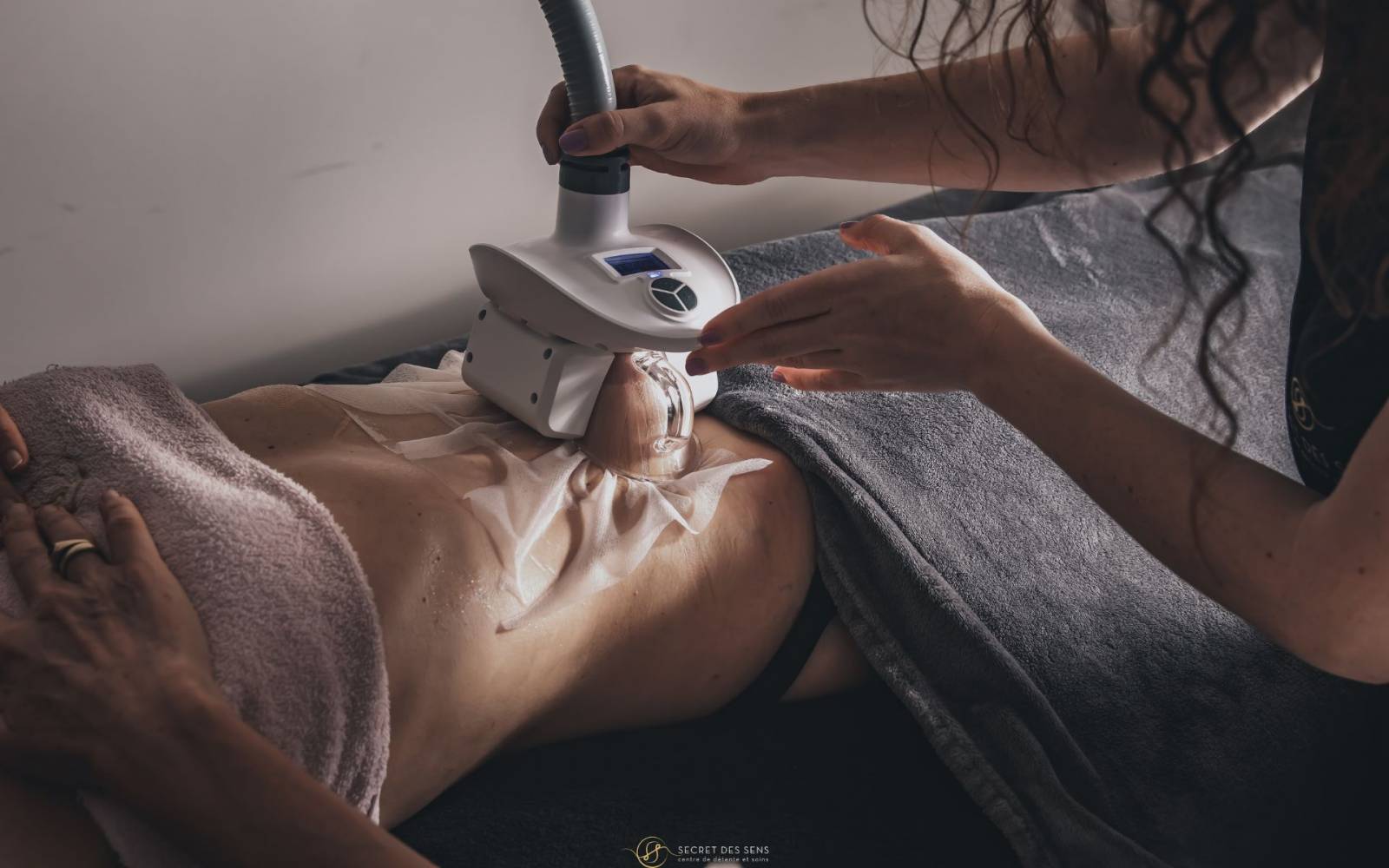 cryolipolyse_minceur_1