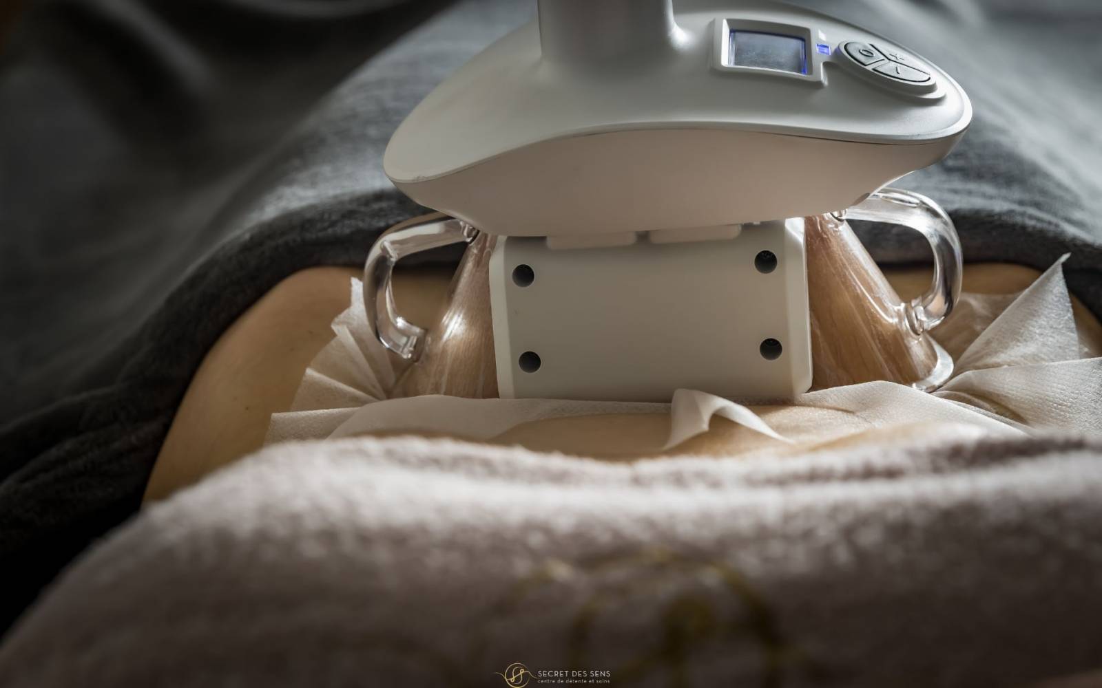 cryolipolyse_minceur_2